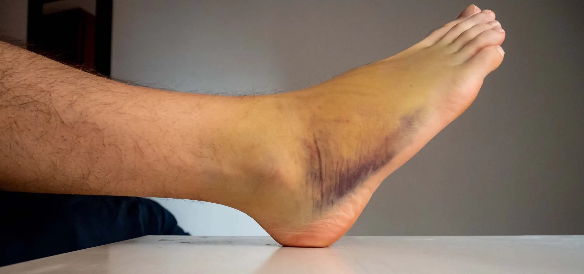 Non-Surgical Treatments For Foot And Ankle Injuries