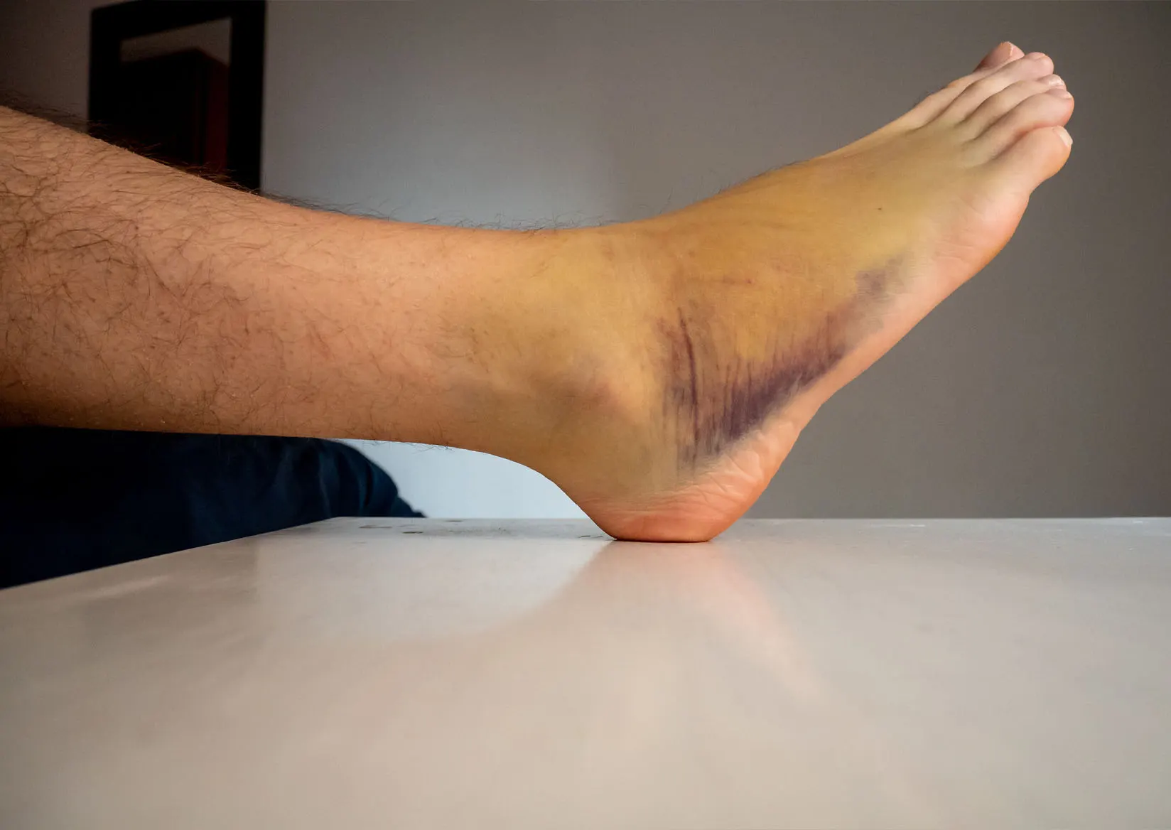 Non-Surgical Treatments For Foot And Ankle Injuries