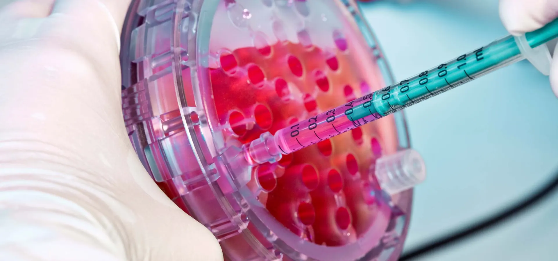 Non-Surgical Stem Cell Treatment For Feet And Ankles