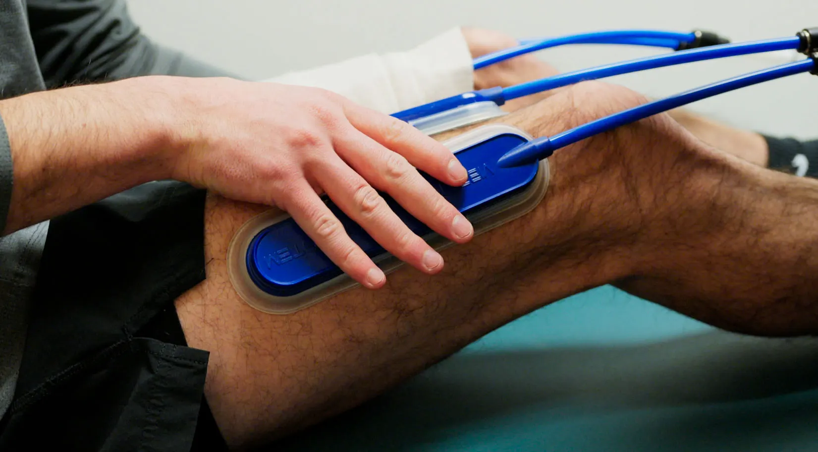 Neuropathy